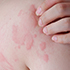 DERMATOLOGICKÉ INFORMÁCIE!